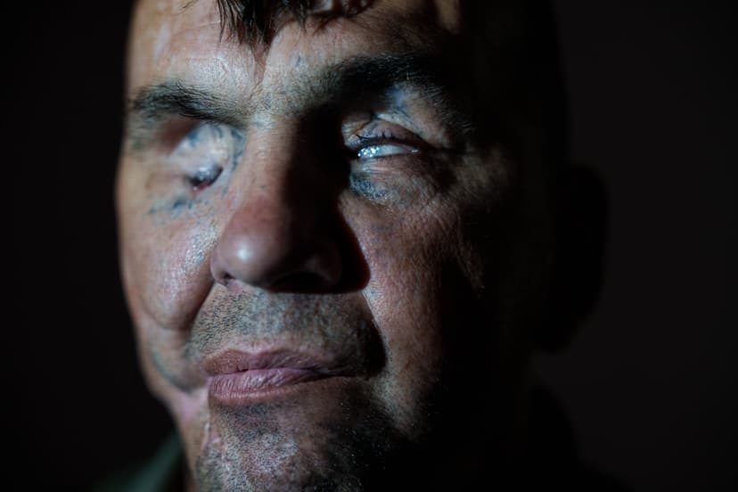 US Surgeons Aid Ukraine Soldier's Fight for Vision