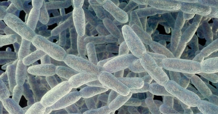 Legionnaires' Deaths Rise to 4 on Upper East Side