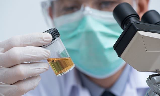 Urine Test Predicts Early Death Risk