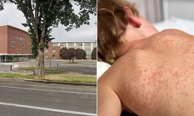 Utah measles alert: 2,000 students exposed