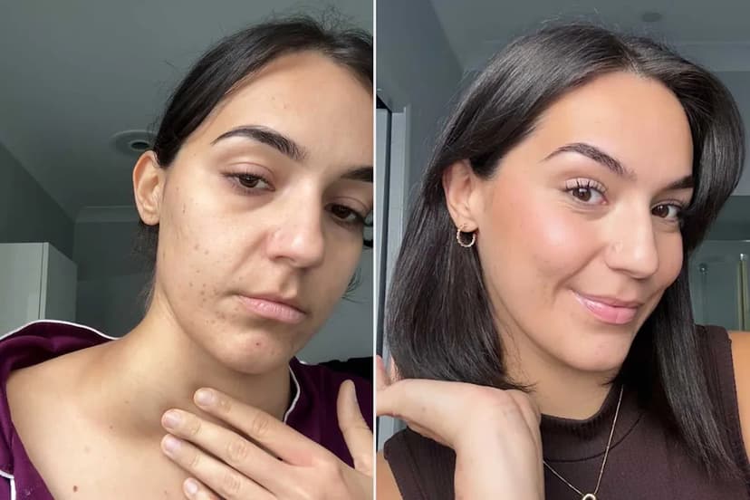 Dismissed by Doctors, Woman Finds Cancer Herself