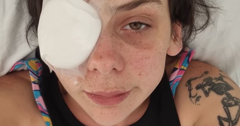 Hangover vision? Woman loses eye to tumor