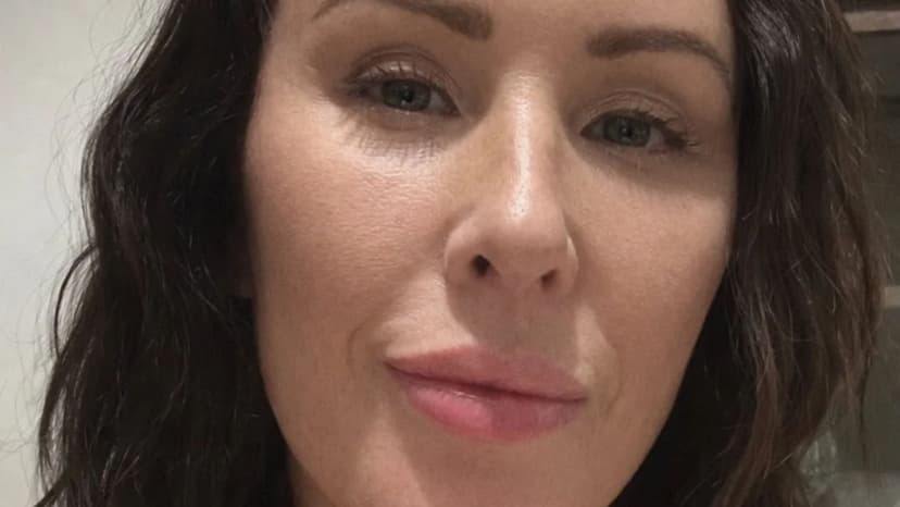 Turkey Facelift: £10k, 19hr Flight, Troll Scathing Review