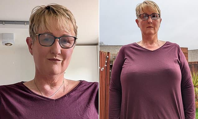 40K Bust Pain: Mum Turned Down 20 Times for NHS Surgery