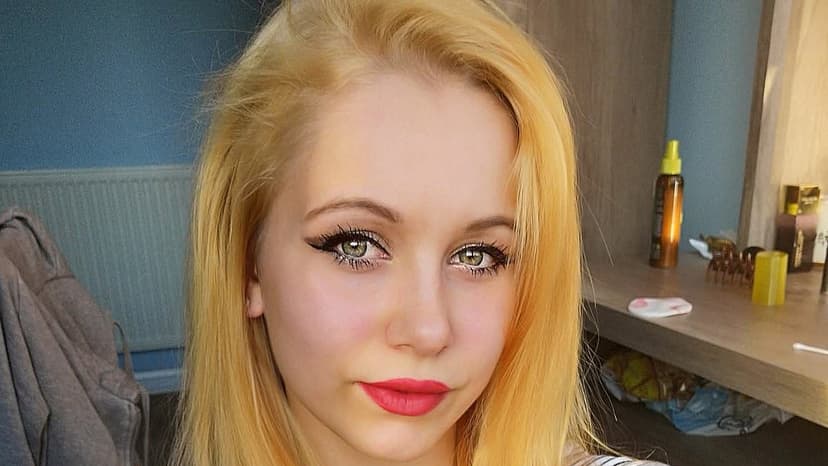 Scalp ripped out: Mum's kids don't recognise her