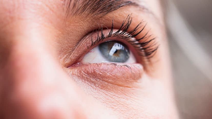 Yellow Eye Patches: Hidden Heart Risk?