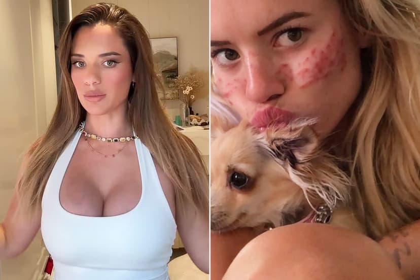 Mom Reverses Cosmetic Procedures After Falling Ill