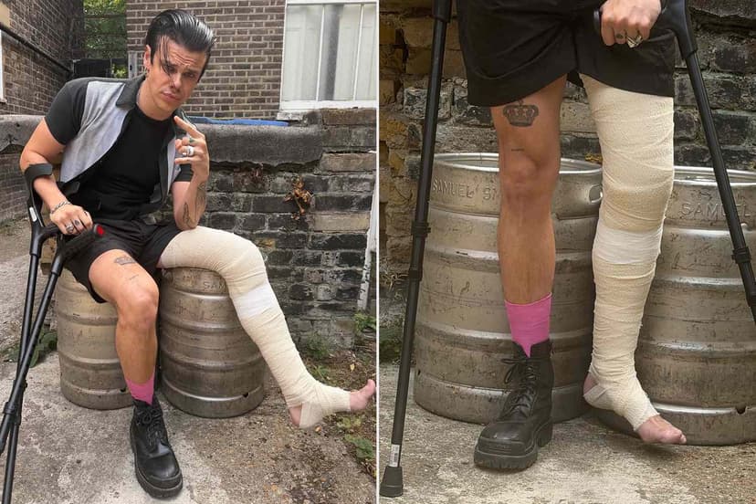 Yungblud Powers Through Injury, Hits the Stage